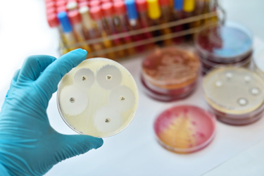 Discovery of new antimicrobial resistance gene
