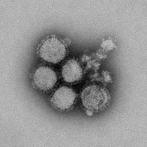Virus de la grippe H1N1 vu au microscope