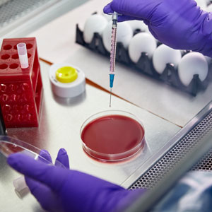 Vérification des faits concernant l’influenza aviaire hautement pathogène (IAHP)