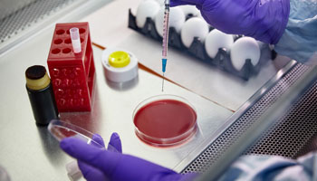 Vérification des faits concernant l’influenza aviaire hautement pathogène (IAHP)