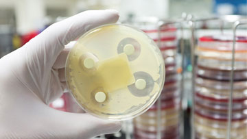 Scientifique tenant une plaque de gélose contenant des antibiotiques sur une culture de bactéries pathogènes.