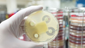 Collaborer pour lutter contre les superbactéries : le projet Résistance aux antimicrobiens - Une seule santé