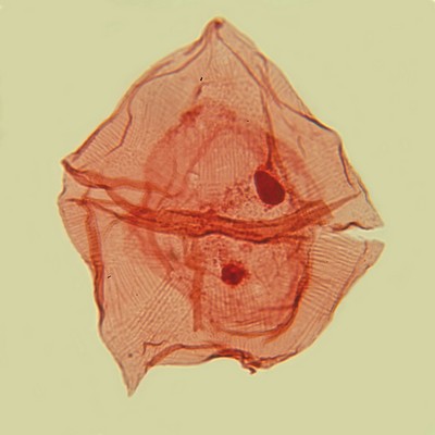 Microfossiles