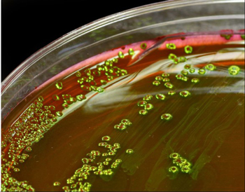 Recommandations pour améliorer les épreuves d'E. coli
