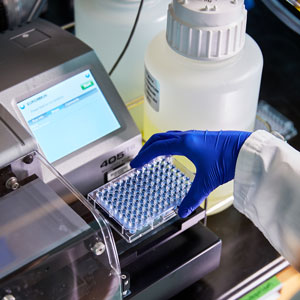 Une recherche sur l’hépatite D souligne la nécessité d’un dépistage accru