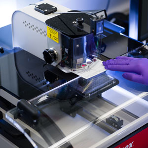 Des scientifiques utilisent l’analyse de gouttes de sang séché pour étudier la propagation de la COVID-19 au Canada