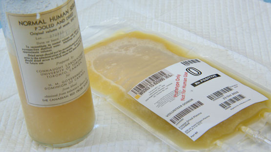 Une bouteille en verre et un sac pour perfusion intraveineuse en plastique contiennent tous deux un liquide jaune. La bouteille de verre porte une étiquette datant de 1943 et le sac pour perfusion intraveineuse porte une étiquette datant de 2019.